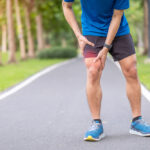 Iliotibial Band Syndrome